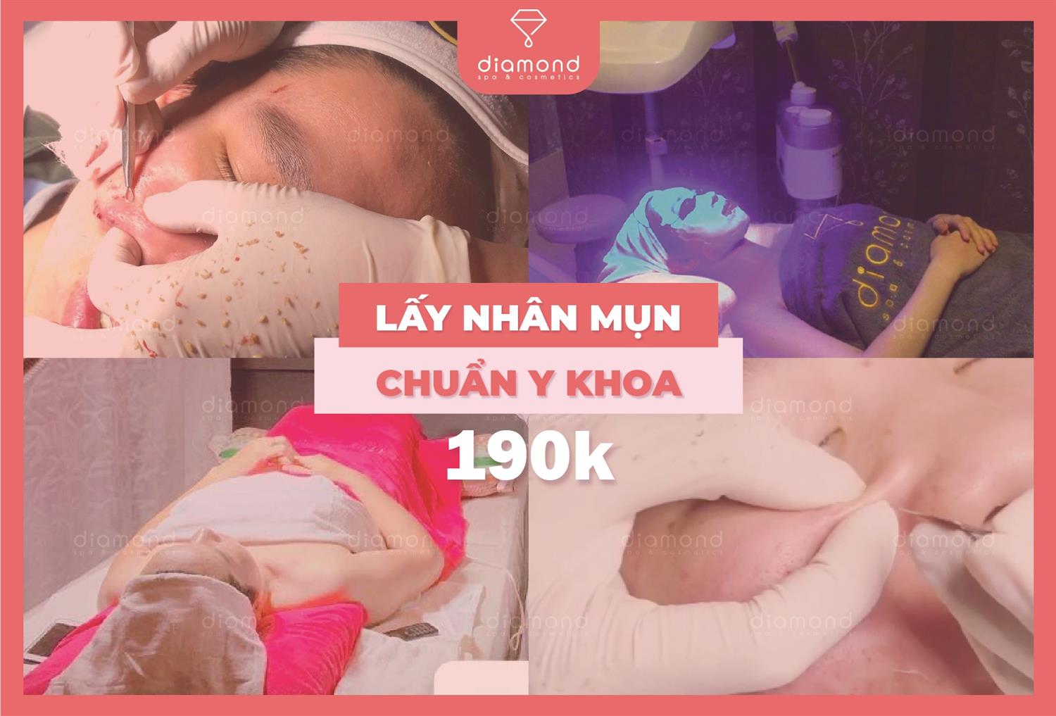 LẤY NHÂN MỤN CHUẨN Y KHOA TẠI DIAMOND SPA CÓ LỢI ÍCH GÌ?