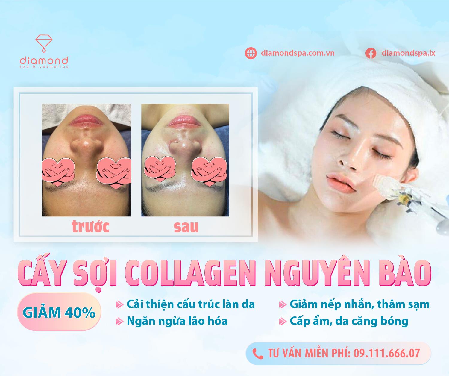 GIẢM 40% CẤY COLLAGEN NGUYÊN BÀO TRONG THÁNG 2