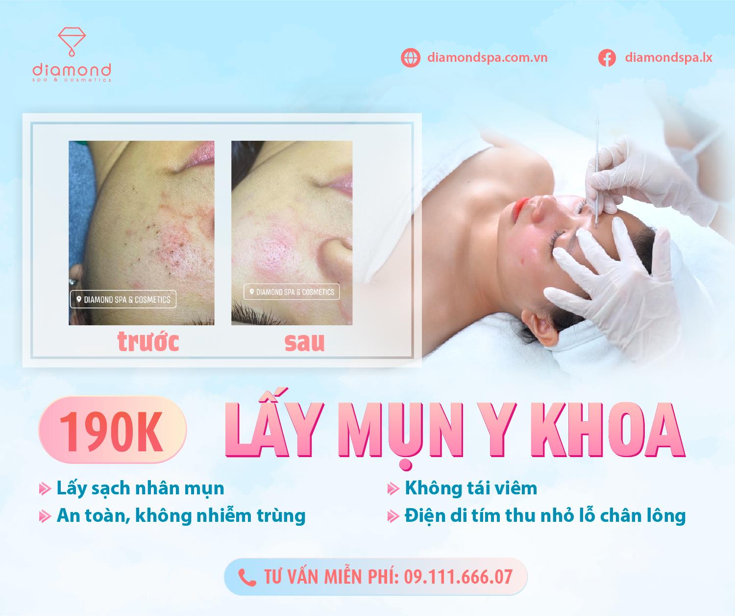 TẠI SAO NÊN LẤY MỤN Y KHOA TẠI DIAMOND SPA?