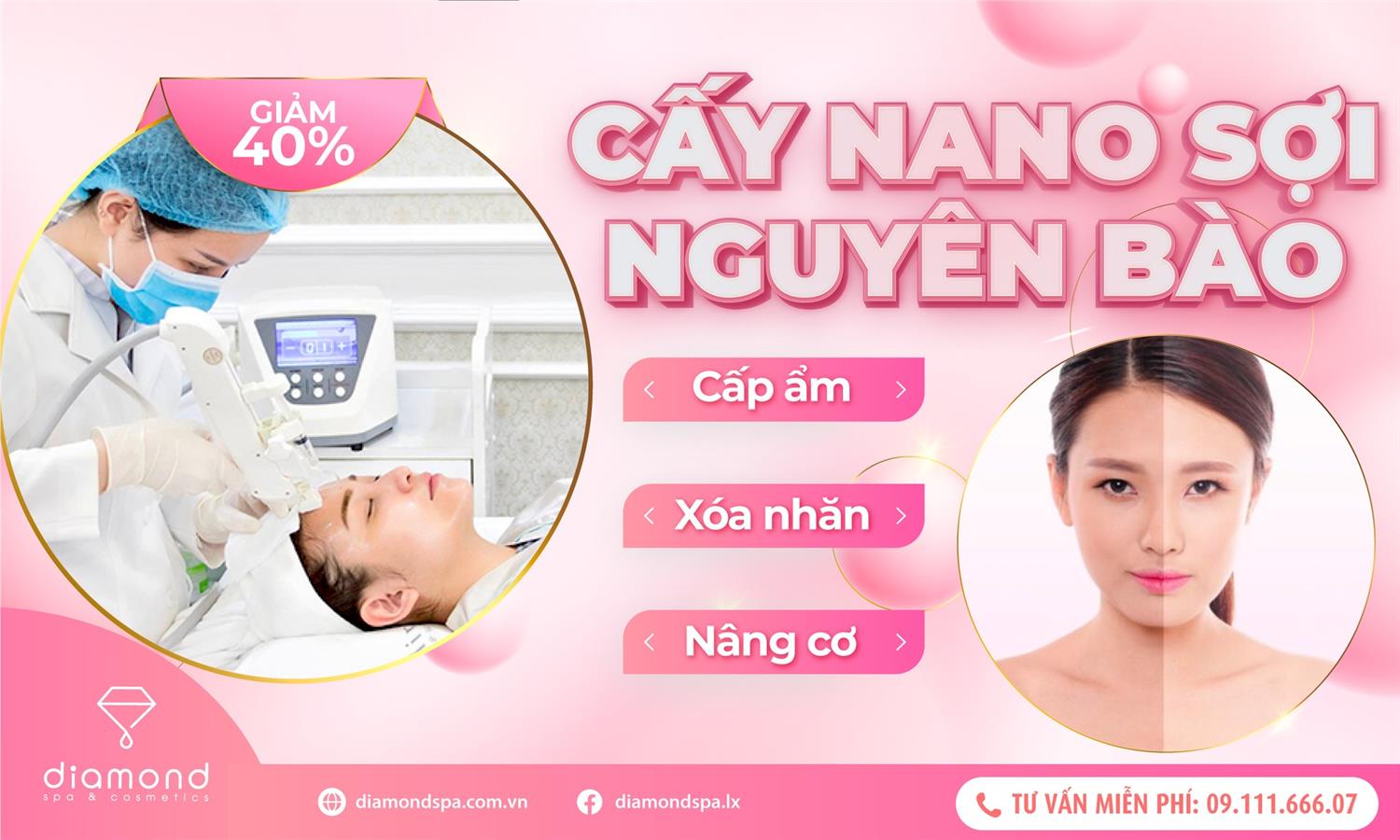 GIẢM 40% - CẤY NANO SỢI NGUYÊN BÀO TRONG THÁNG 3