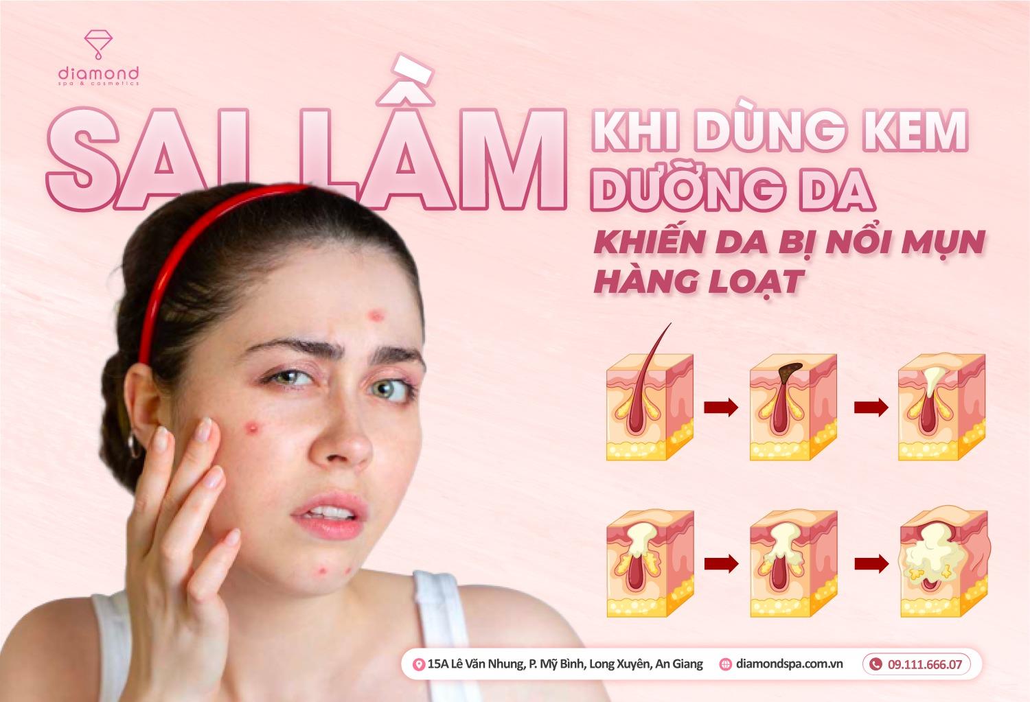 SAI LẦM KHI DÙNG KÈM DƯỠNG DA KHIẾN DA BỊ NỔI MỤN HÀNG LOẠT