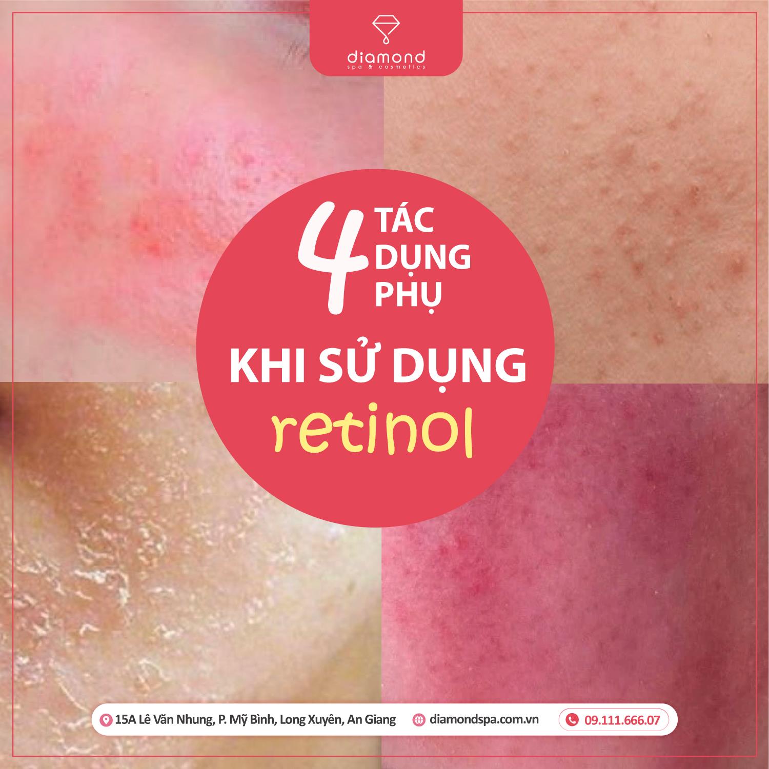 4 TÁC DỤNG PHỤ THƯỜNG GẶP KHI SỬ DỤNG RETINOL & CÁCH KHẮC PHỤC