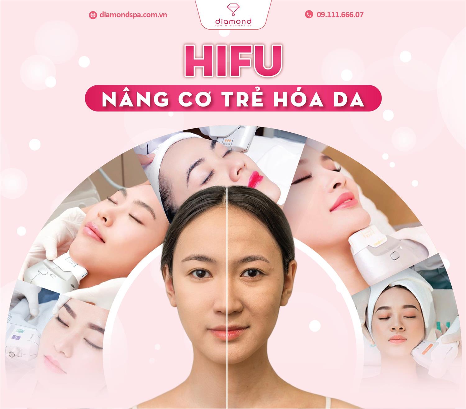 HIFU - NÂNG CƠ TRẺ HÓA DA