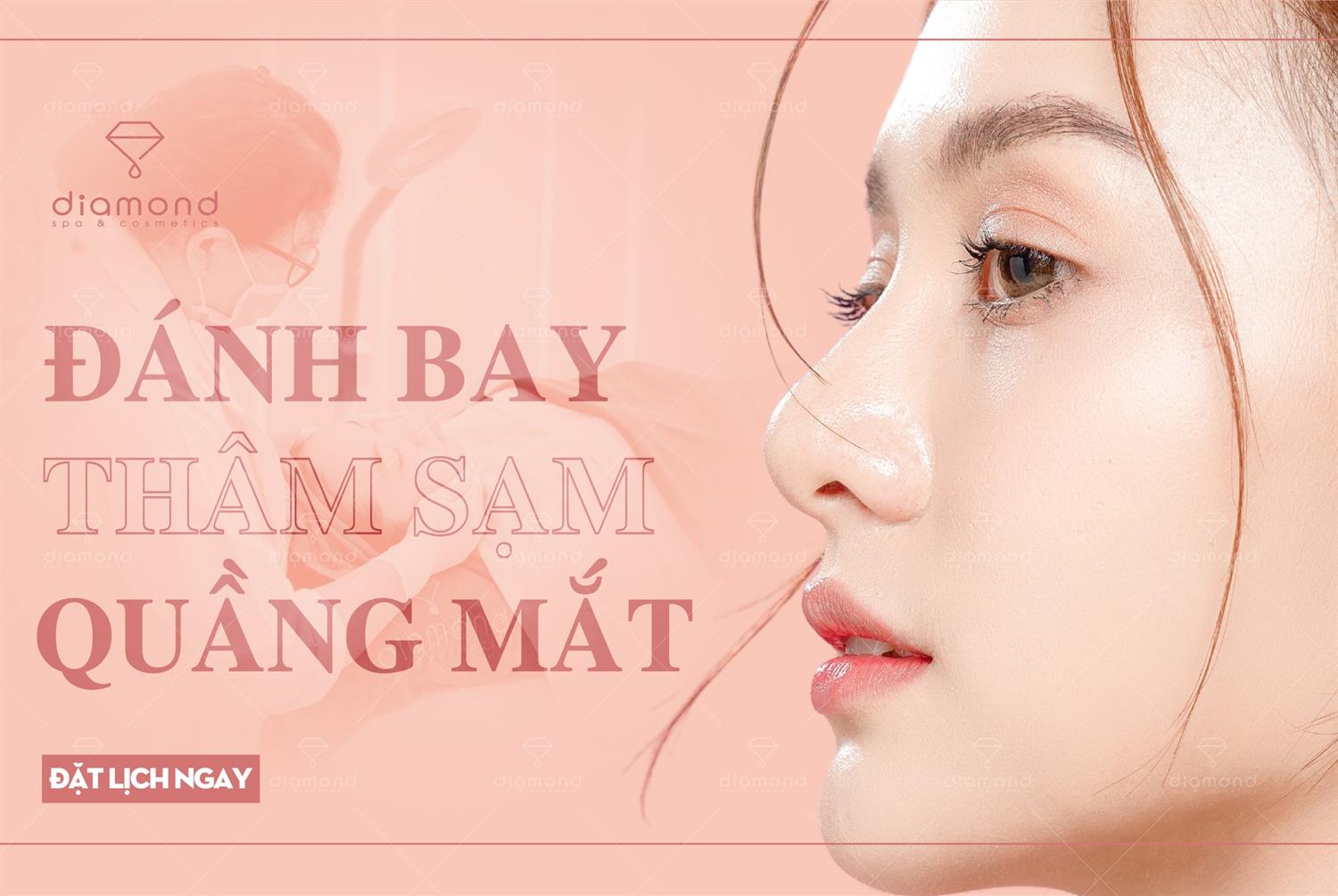 ĐÁNH BAY THÂM SẠM VÙNG MẮT