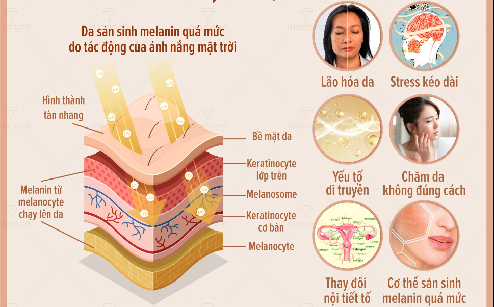 NGUYÊN NHÂN NÀO GÂY RA TÀN NHAN VÀ ĐỐM NÂU?