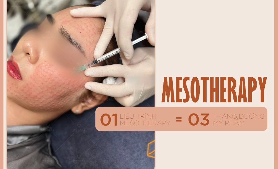 1 LIỆU TRÌNH MESOTHERAPY BẰNG 3 THÁNG DƯỠNG MỸ PHẨM