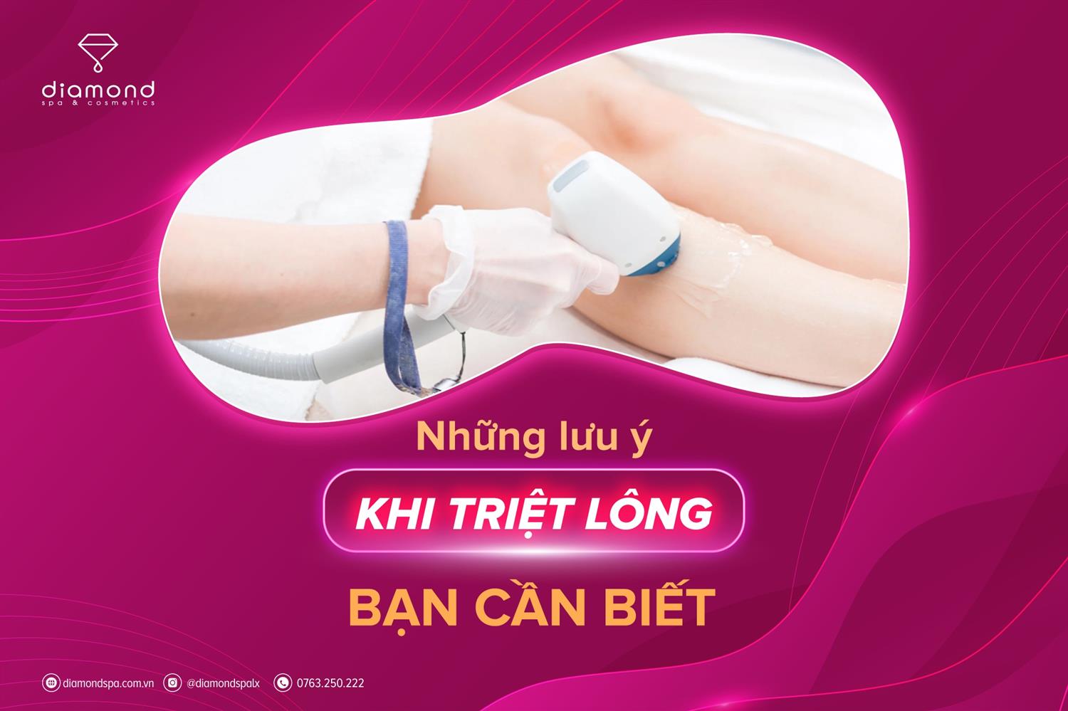 6 LƯU Ý TRƯỚC VÀ SAU KHI TRIỆT LÔNG