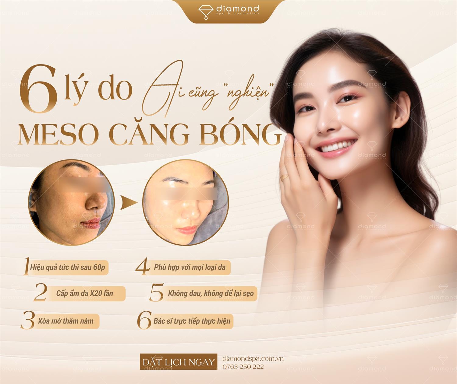 6 LÝ DO AI CŨNG NGHIỆN MESO CĂNG BÓNG