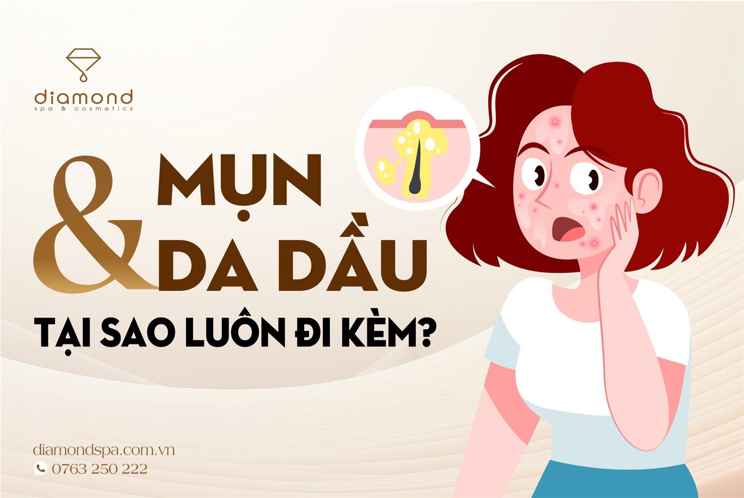 TẠI SAO MỤN THƯỜNG ĐI KÈM DA DẦU?