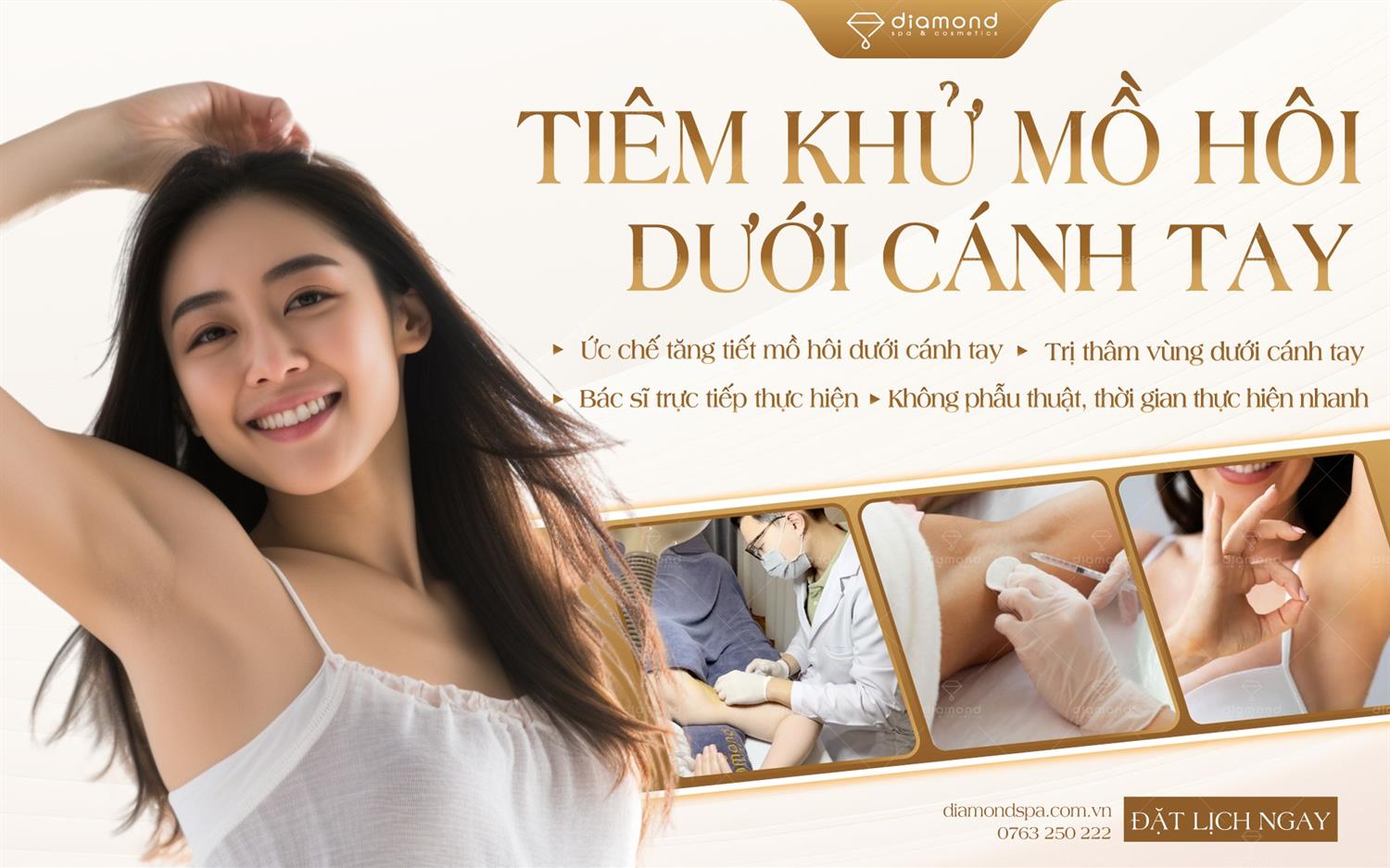 TIÊM KHỬ MỒ HÔI DƯỚI CÁNH TAY