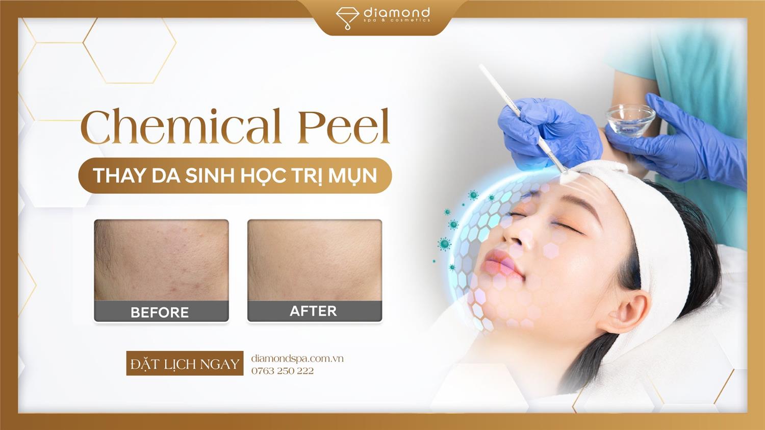 CHEMICAL PEEL - THAY DA SINH HỌC