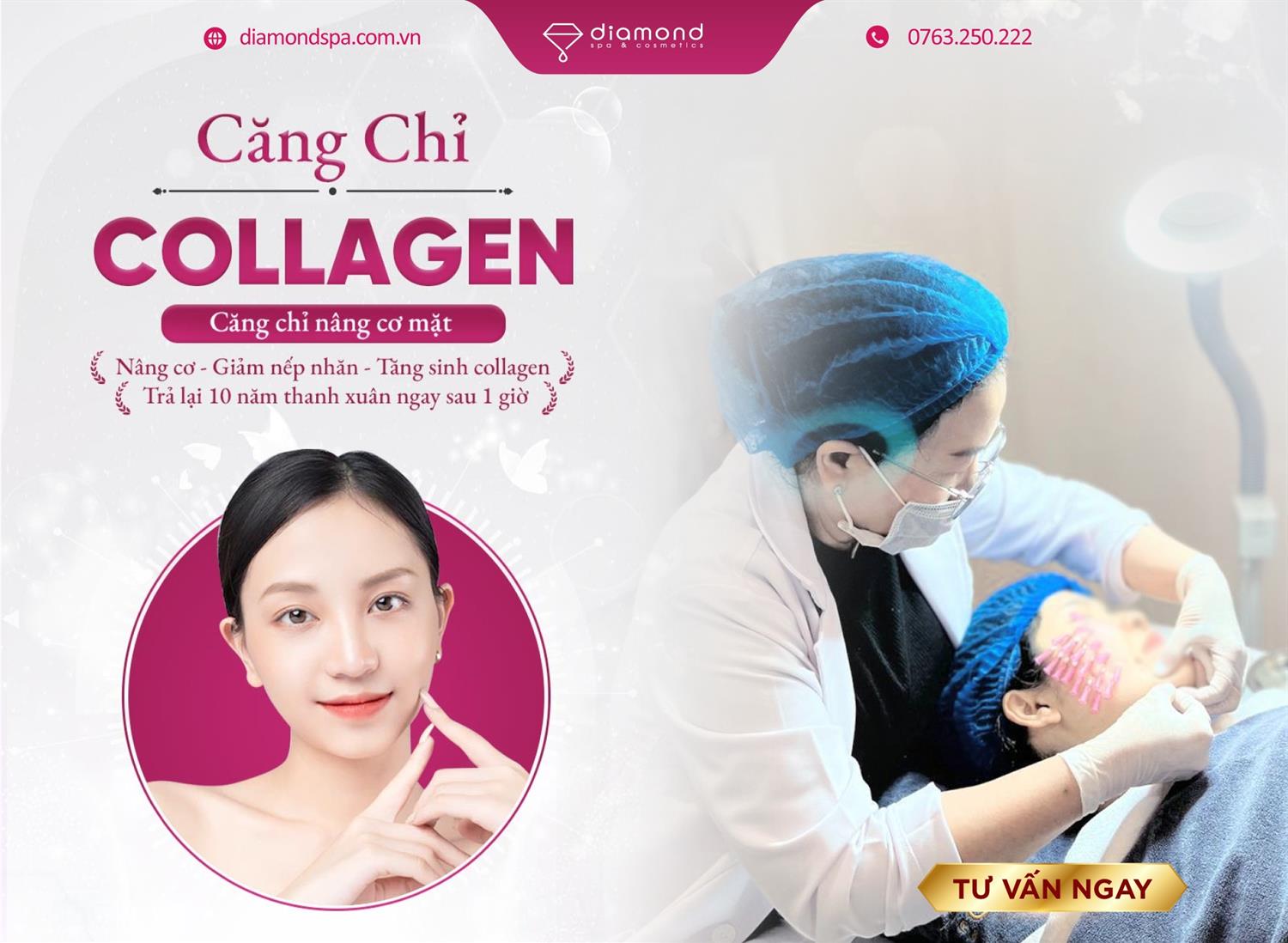 CĂNG CHỈ COLLAGEN