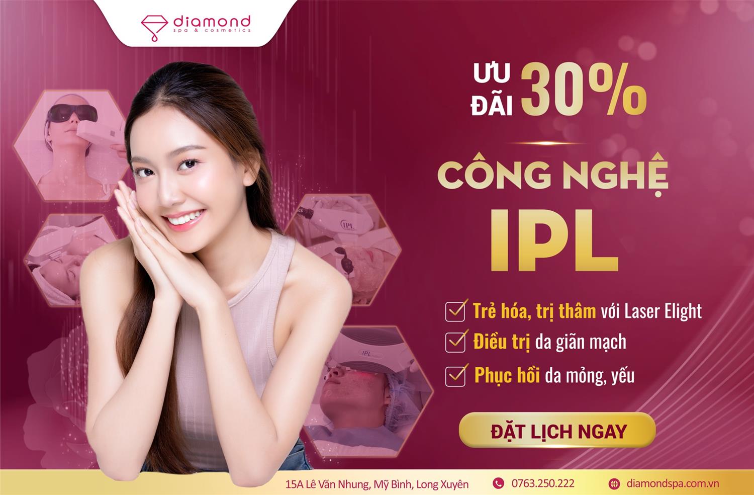 CÔNG NGHỆ IPL