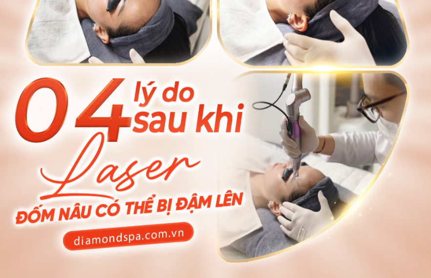 4 LÝ DO ĐỐM NÂU ĐẬM LÊN SAU KHI LASER