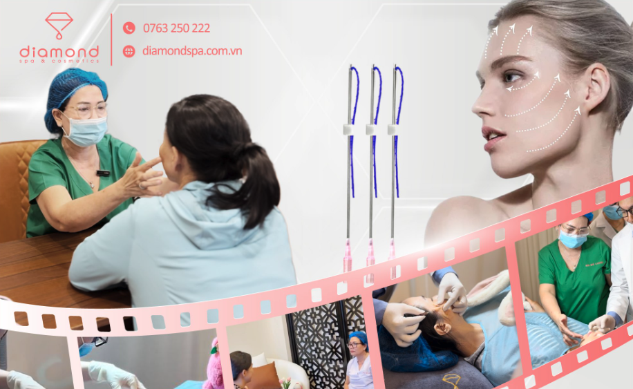 GIẢM NGAY 20% CĂNG CHỈ COLLAGEN - DUY NHẤT NGÀY 07.06.2025