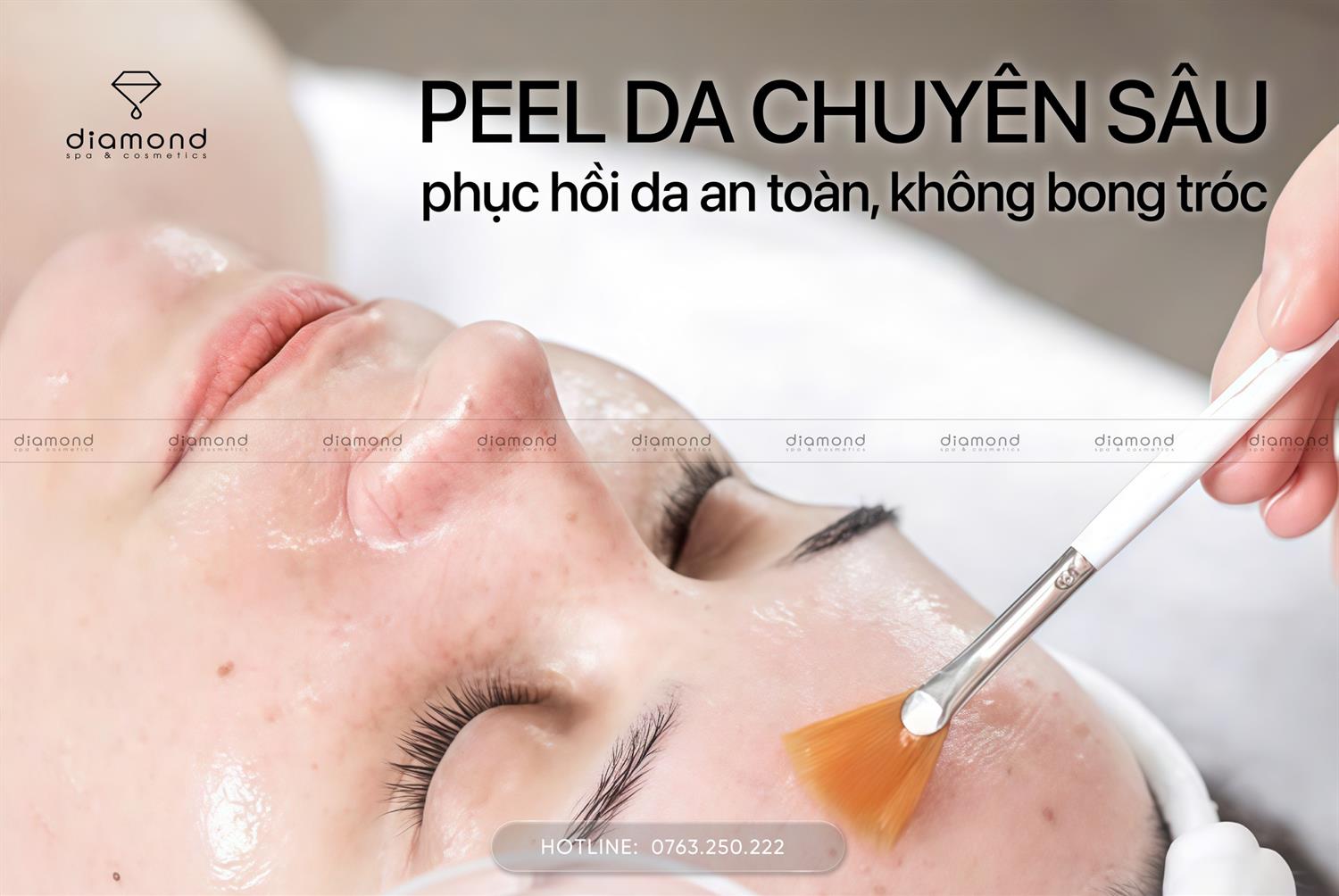 PEEL DA CHUYÊN SÂU – PHỤC HỒI DA AN TOÀN, KHÔNG BONG TRÓC
