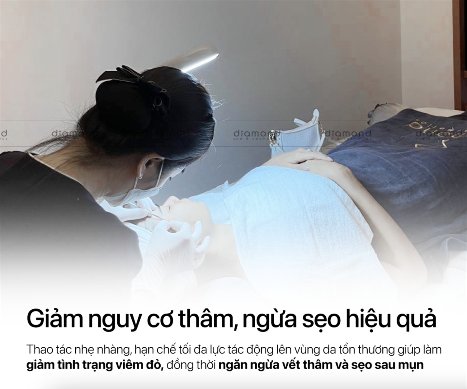 LẤY MỤN CHUẨN Y KHOA – BƯỚC ĐẦU CỦA LÀN DA KHỎE 