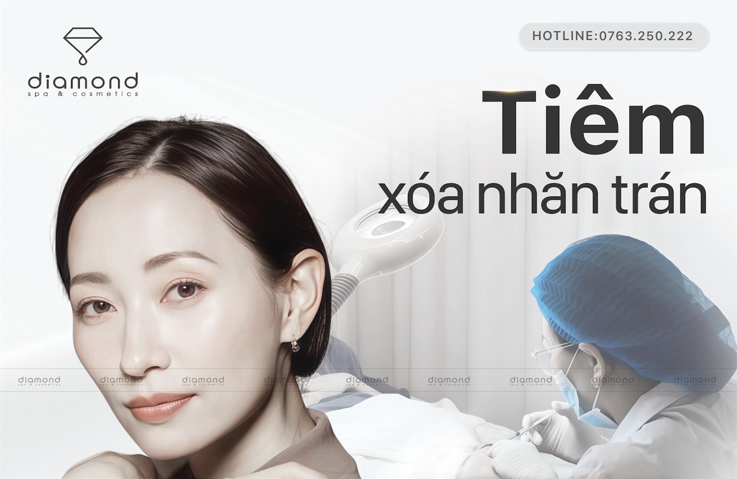 TIÊM XÓA NHĂN TRÁN