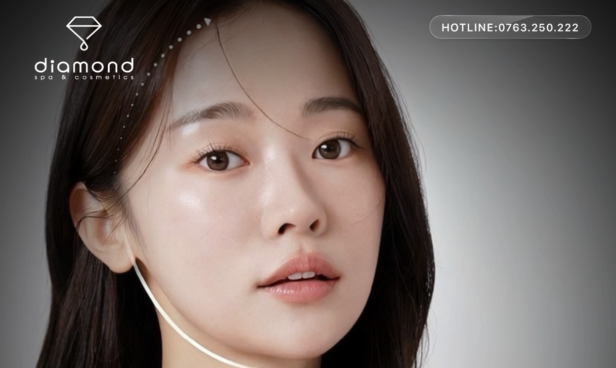 TIÊM THON GỌN HÀM V-LINE - GƯƠNG MẶT THANH THOÁT, KHÔNG CẦN DAO KÉO