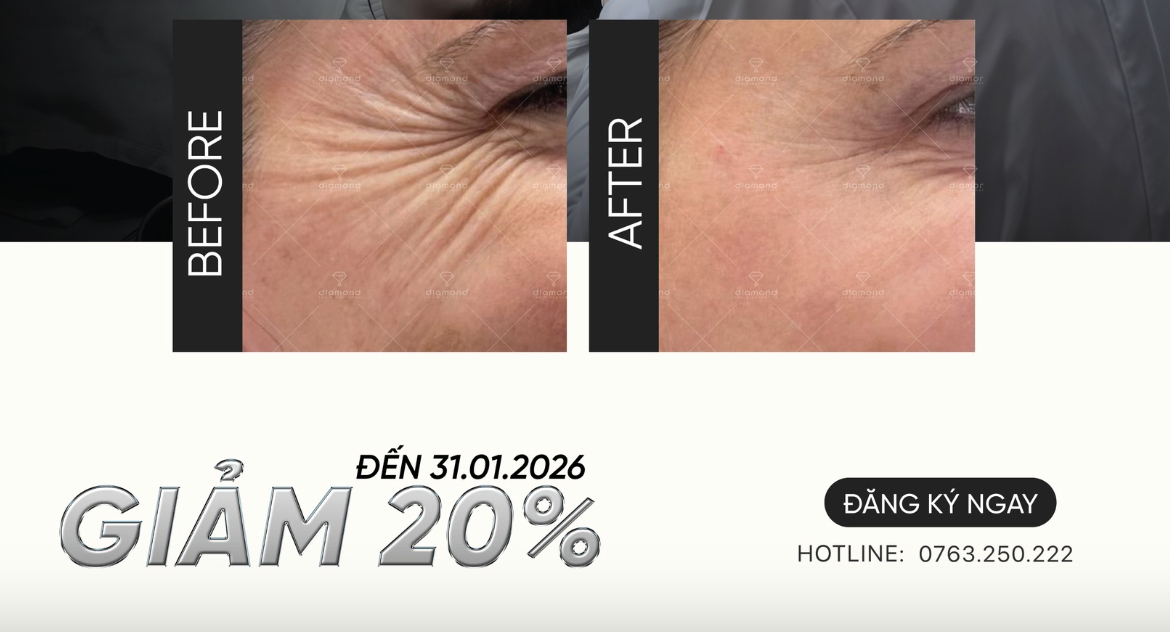 TIÊM TRẺ HÓA MẮT