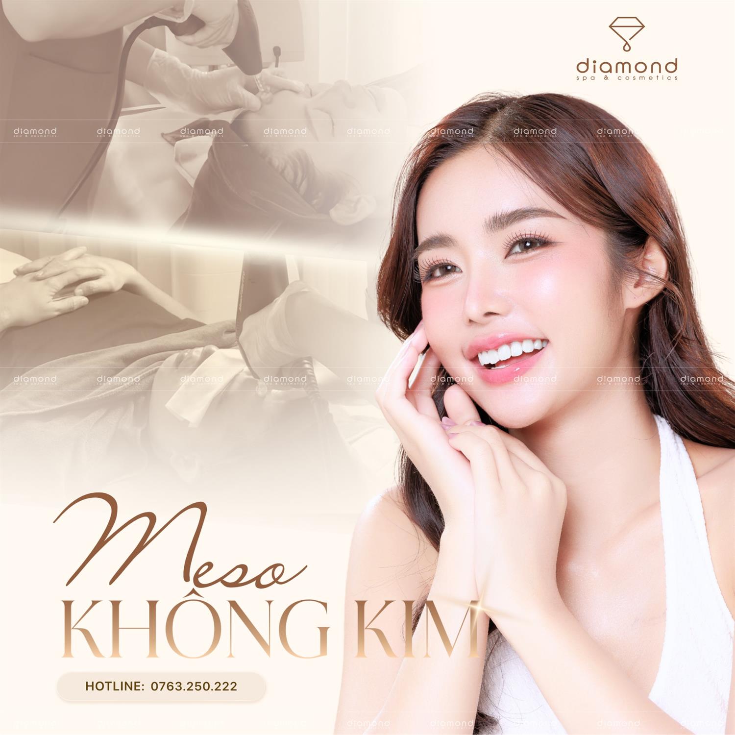 MESO KHÔNG KIM “MESO FILLER PRO”