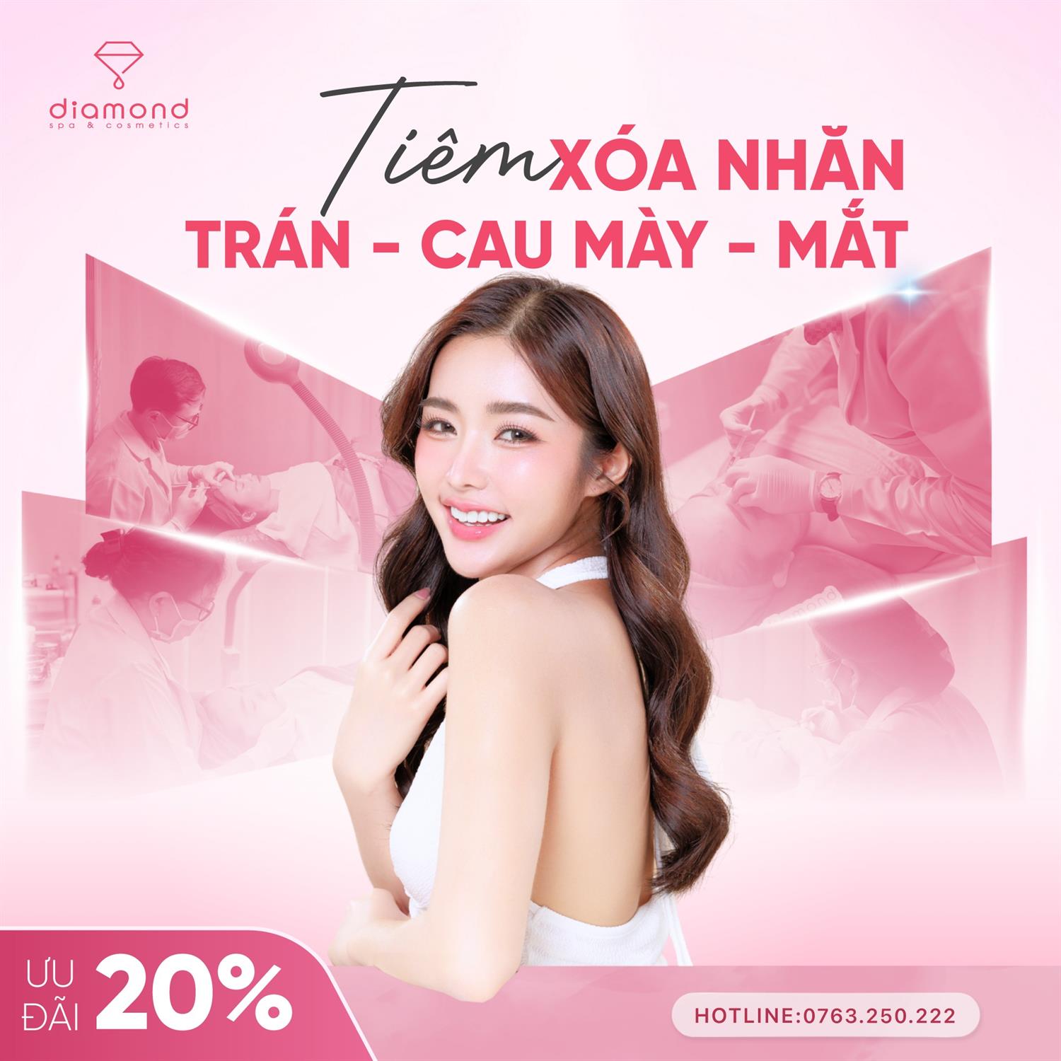 TIÊM XÓA NHĂN TRÁN - CAU MÀY - MẮT