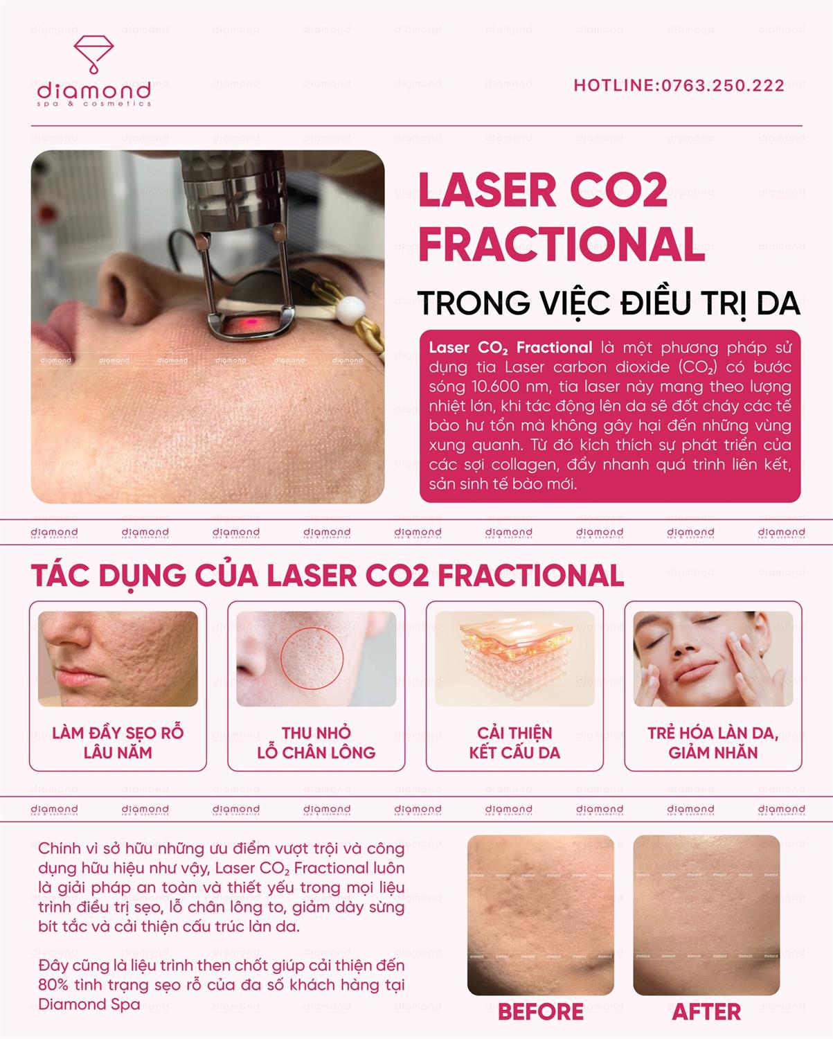 LASER CO2 FRACTIONAL TRONG VIỆC ĐIỀU TRỊ DA