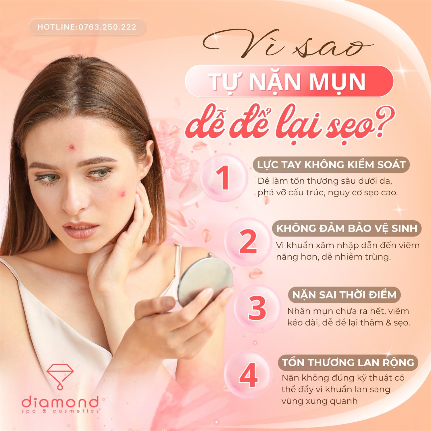 VÌ SAO TỰ NẶN MỤN DỄ ĐỂ LẠI SẸO?