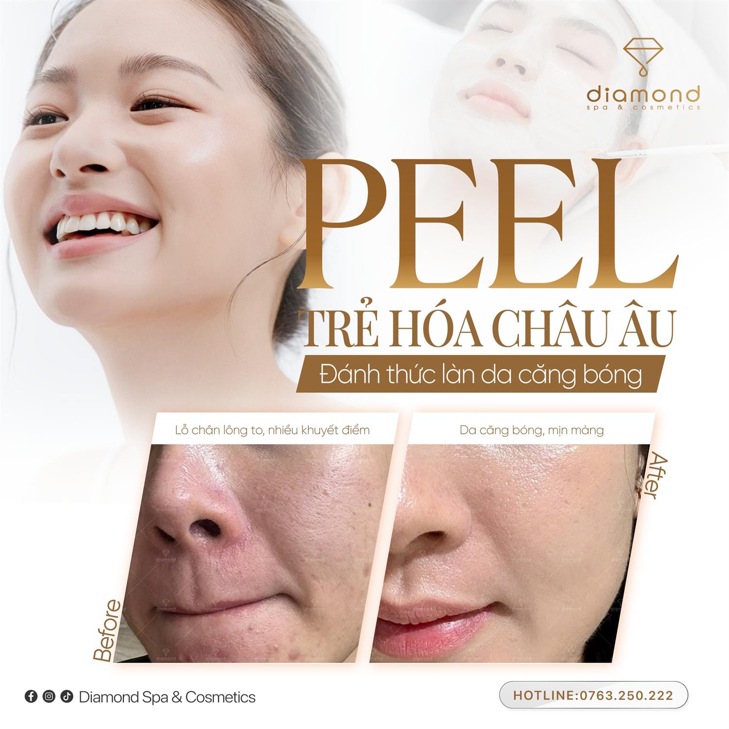 PEEL TRẺ HÓA CHÂU ÂU – ĐÁNH THỨC LÀN DA CĂNG BÓNG RẠNG RỠ!
