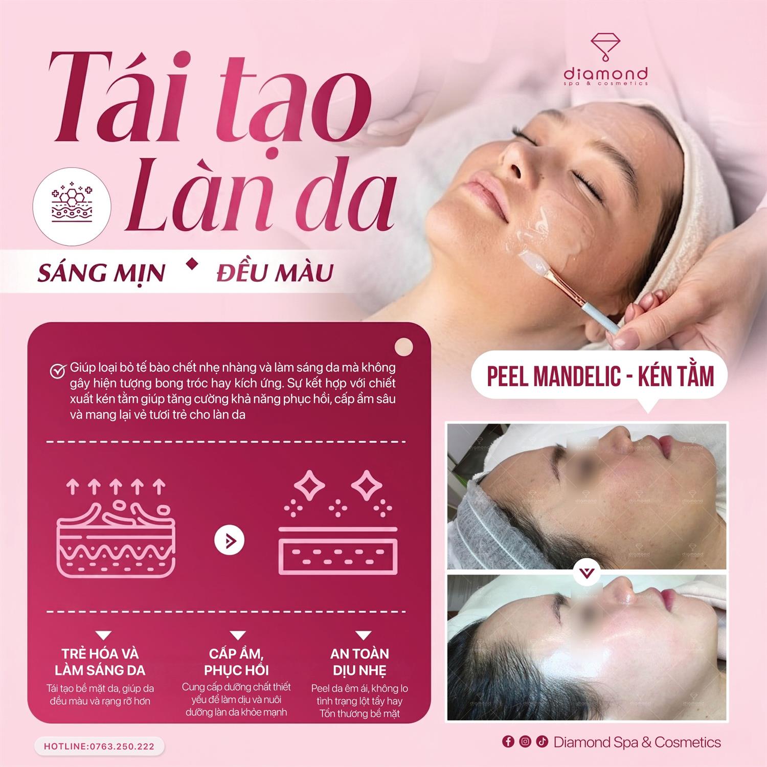 PEEL MANDELIC - TÁI TẠO LÀN DA ĐỀU MÀU