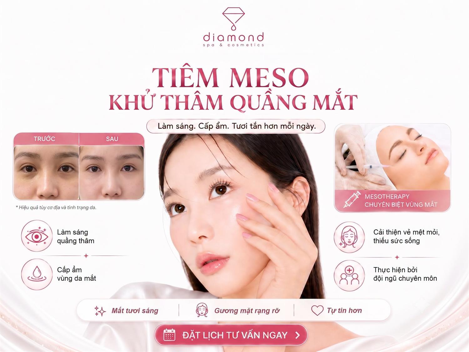 TIÊM MESO KHỬ THÂM QUẦNG MẮT 