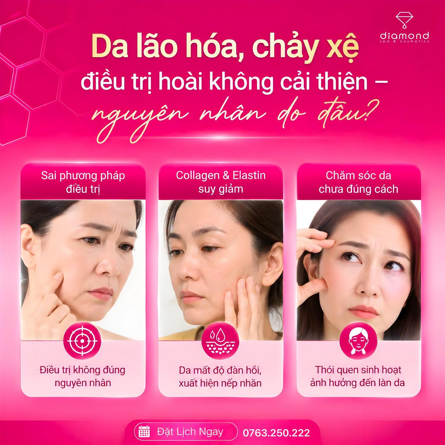 LÃO HÓA - CHẢY XỆ: LIỆU CÓ THỂ ĐẢO NGƯỢC NẾU CHỈ CHĂM DA TẠI NHÀ?