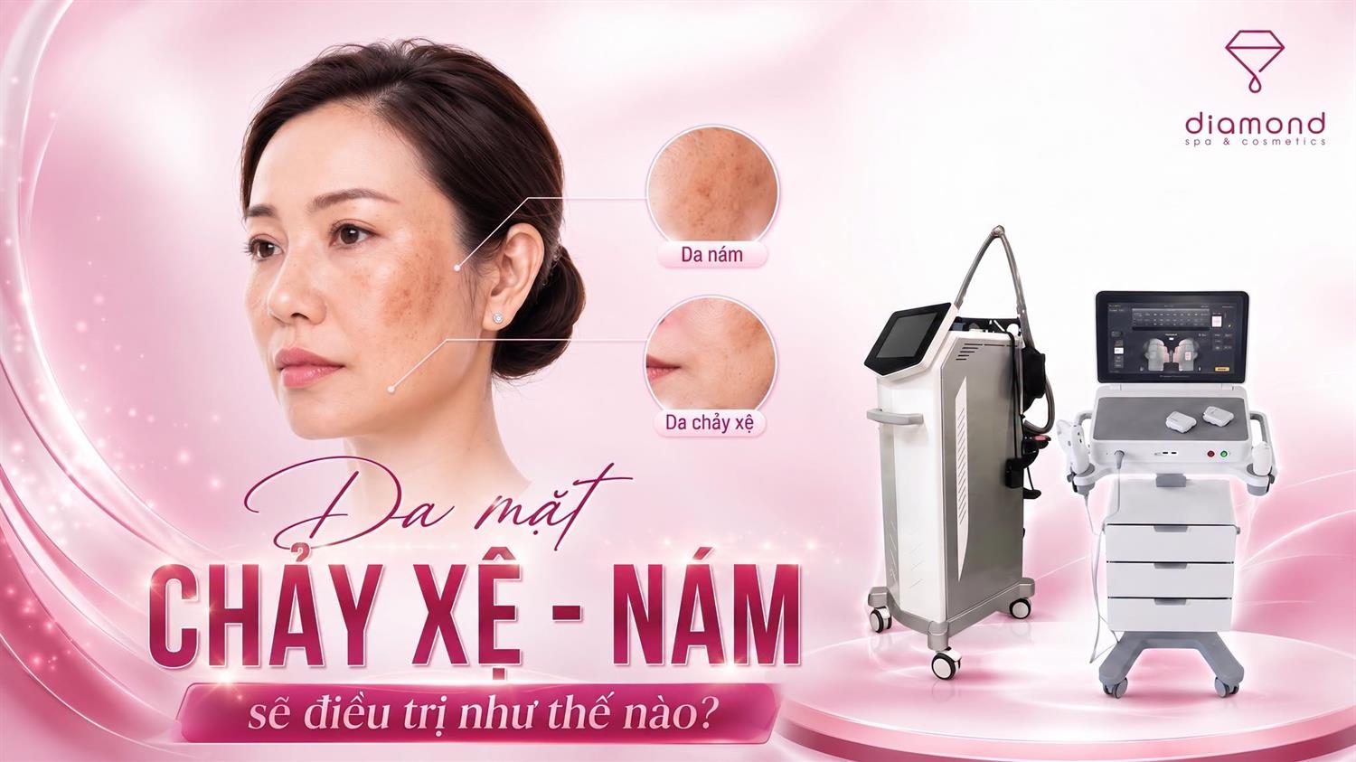 KHI NỀN DA BÁO ĐỘNG ĐỒNG THỜI: CHẢY XỆ & NÁM SẠM