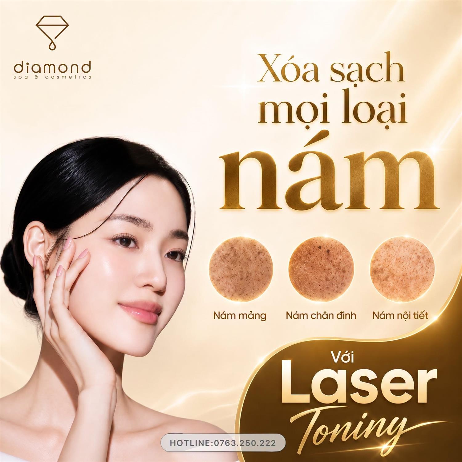 THỔI BAY NỖI LO NÁM VỚI LASER TONING