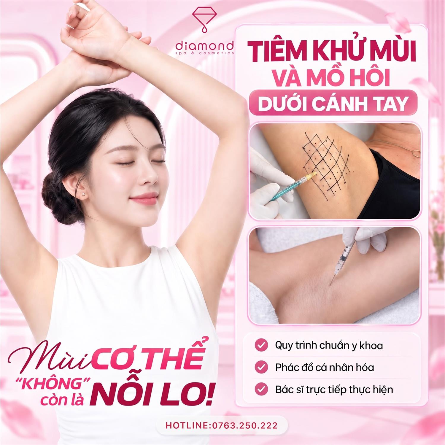TIÊM KHỬ MÙI VÀ MỒ HÔI DƯỚI CÁNH TAY