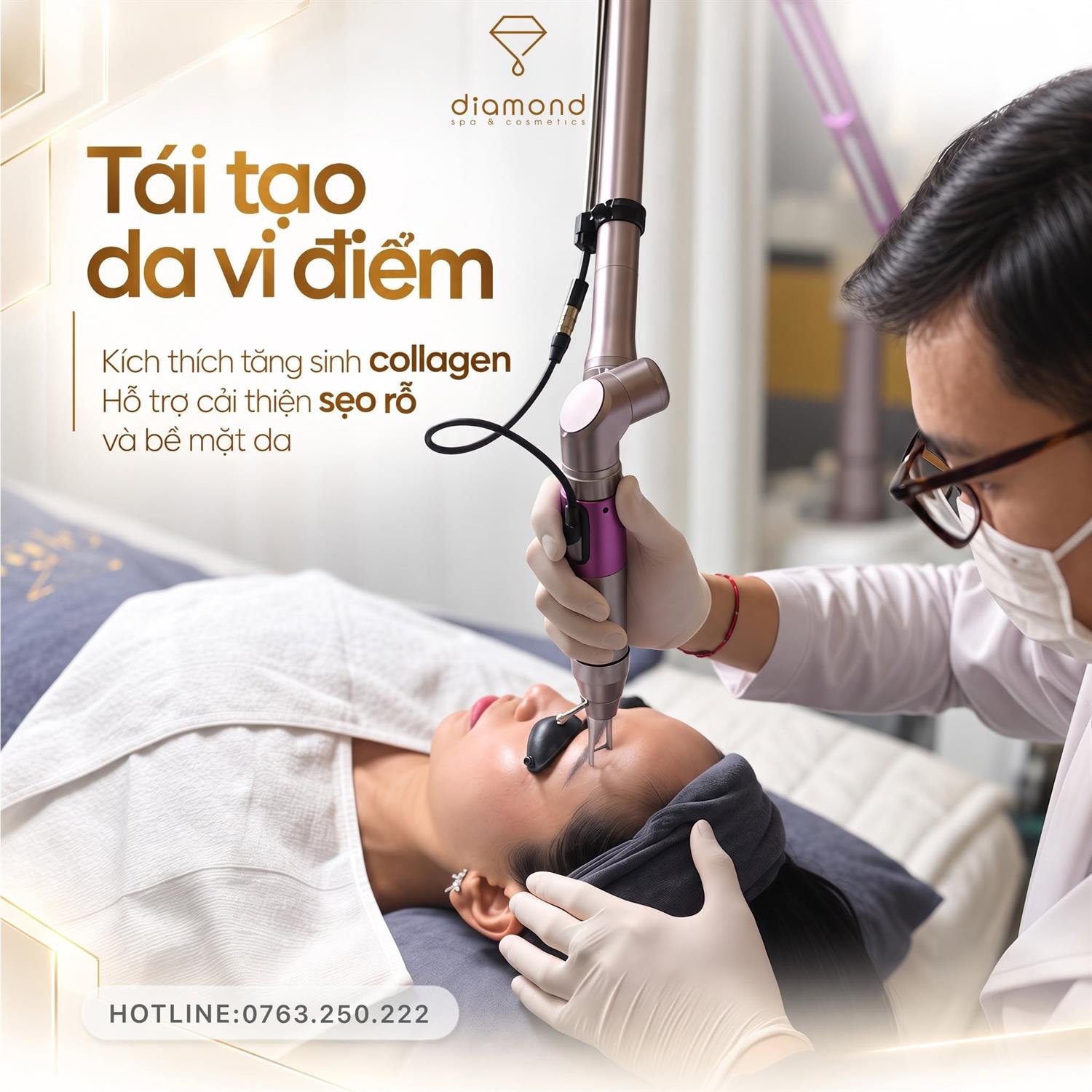 LASER CO2 FRACTIONAL HỖ TRỢ CẢI THIỆN SẸO RỖ